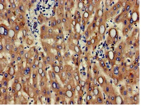 Immunohistochemistry (Formalin/PFA-fixed paraffin-embedded sections) - Anti-CD166 antibody (AB235957)