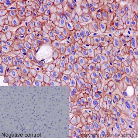 Immunohistochemistry (Formalin/PFA-fixed paraffin-embedded sections) - Anti-CD166 antibody [EPR2759(2)] (AB109215)