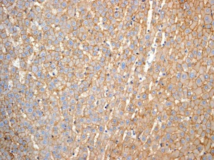 Immunohistochemistry (Formalin/PFA-fixed paraffin-embedded sections) - Anti-CD166 antibody [EPR2759(2)] - BSA and Azide free (ab206127), expandable thumbnail