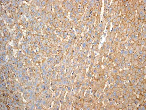 Immunohistochemistry (Formalin/PFA-fixed paraffin-embedded sections) - Anti-CD166 antibody [EPR2759(2)] - BSA and Azide free (AB206127)