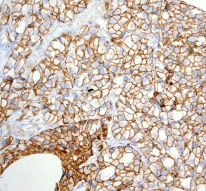 Immunohistochemistry (Formalin/PFA-fixed paraffin-embedded sections) - Anti-CD166 antibody [EPR2759(2)] - BSA and Azide free (ab206127), expandable thumbnail