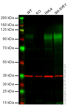 Western blot - Anti-CD166 antibody [EPR2759(2)] - BSA and Azide free (AB206127), expandable thumbnail