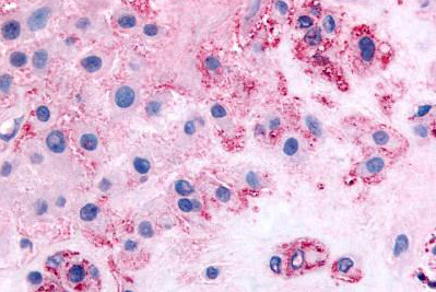 Immunohistochemistry (Formalin/PFA-fixed paraffin-embedded sections) - Anti-CD167a/DDR1 antibody (AB150506), expandable thumbnail