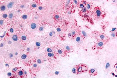 Immunohistochemistry (Formalin/PFA-fixed paraffin-embedded sections) - Anti-CD167a/DDR1 antibody (AB150506)
