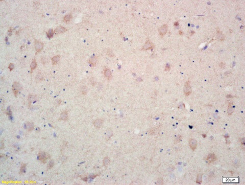 Immunohistochemistry (Formalin/PFA-fixed paraffin-embedded sections) - Anti-CD167a/DDR1 antibody (AB216963)