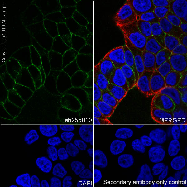 Immunocytochemistry/ Immunofluorescence - Anti-CD167a/DDR1 antibody [EPR22316-508] (AB255810), expandable thumbnail
