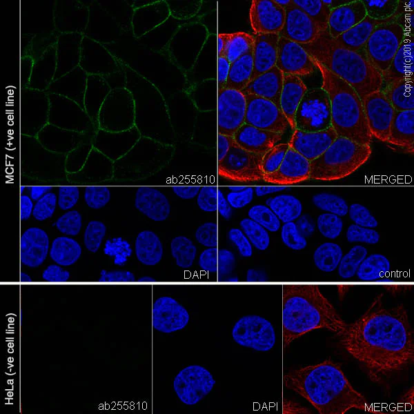 Immunocytochemistry/ Immunofluorescence - Anti-CD167a/DDR1 antibody [EPR22316-508] - BSA and Azide free (AB261728)