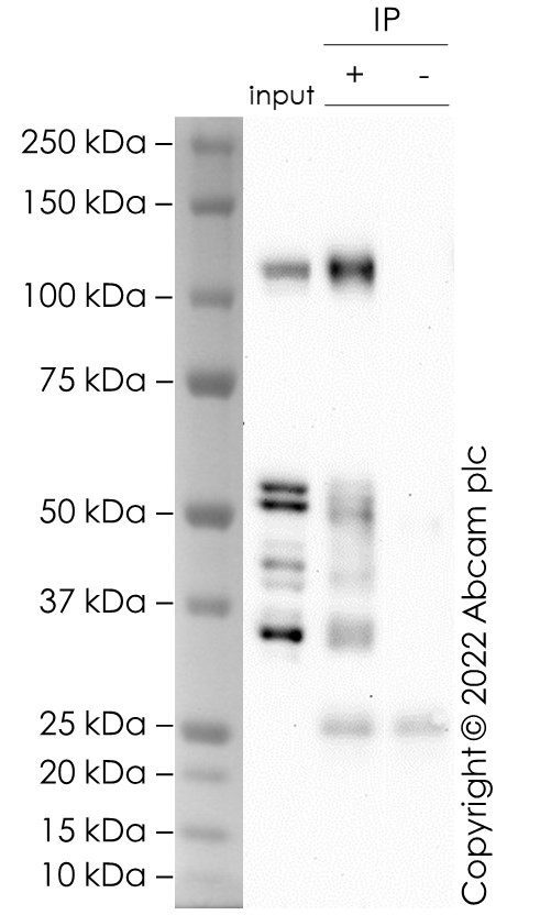 Immunoprecipitation - Anti-CD167a/DDR1 antibody [EPR24783-7] (AB288675), expandable thumbnail