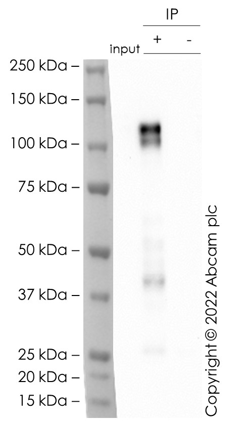 Immunoprecipitation - Anti-CD167a/DDR1 antibody [EPR24783-7] (AB288675), expandable thumbnail