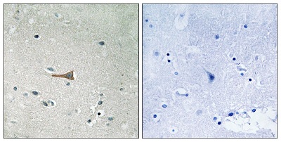 Immunohistochemistry (Formalin/PFA-fixed paraffin-embedded sections) - Anti-CD167a/DDR1 (phospho Y513) antibody (AB193550), expandable thumbnail