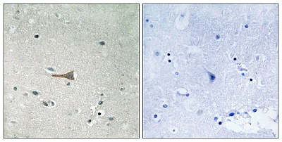 Immunohistochemistry (Formalin/PFA-fixed paraffin-embedded sections) - Anti-CD167a/DDR1 (phospho Y513) antibody (AB193550)