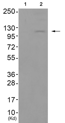 Western blot - Anti-CD167a/DDR1 (phospho Y513) antibody (AB193550), expandable thumbnail