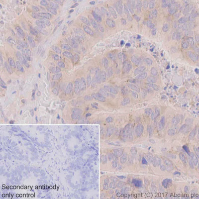 Immunohistochemistry (Formalin/PFA-fixed paraffin-embedded sections) - Anti-CD168 antibody [EPR4054] (AB124729)