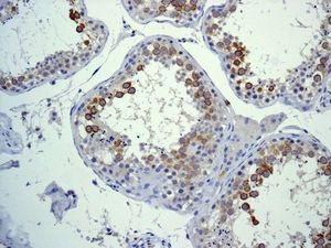 Immunohistochemistry (Formalin/PFA-fixed paraffin-embedded sections) - Anti-CD168 antibody [EPR4054] - BSA and Azide free (AB271887)