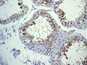 Immunohistochemistry (Formalin/PFA-fixed paraffin-embedded sections) - Anti-CD168 antibody [EPR4054] - Low endotoxin, Azide free (AB228482)