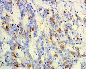 Immunohistochemistry (Formalin/PFA-fixed paraffin-embedded sections) - Anti-CD168 antibody [EPR4055] (AB108339)