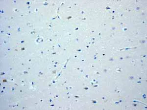 Immunohistochemistry (Formalin/PFA-fixed paraffin-embedded sections) - Anti-CD168 antibody [EPR4055] (AB108339)
