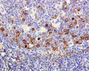 Immunohistochemistry (Formalin/PFA-fixed paraffin-embedded sections) - Anti-CD168 antibody [EPR4055] (AB108339)