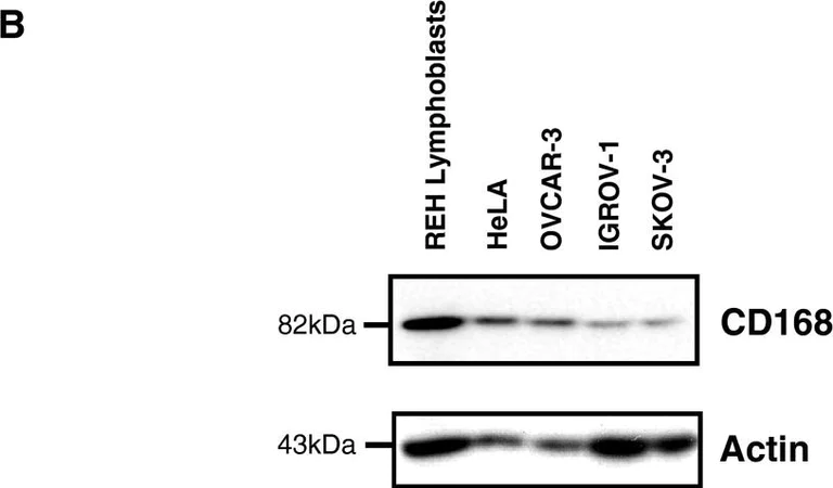 Western blot - Anti-CD168 antibody [EPR4055] (AB108339)