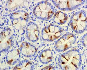 Immunohistochemistry (Formalin/PFA-fixed paraffin-embedded sections) - Anti-CD168 antibody [EPR4055] - BSA and Azide free (AB271875)