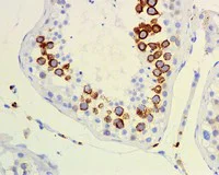 Immunohistochemistry (Formalin/PFA-fixed paraffin-embedded sections) - Anti-CD168 antibody [EPR4055] - BSA and Azide free (AB271875)