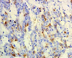 Immunohistochemistry (Formalin/PFA-fixed paraffin-embedded sections) - Anti-CD168 antibody [EPR4055] - Low endotoxin, Azide free (AB229447)