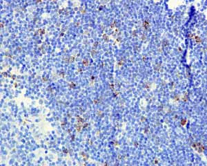 Immunohistochemistry (Formalin/PFA-fixed paraffin-embedded sections) - Anti-CD168 antibody [EPR4055] - Low endotoxin, Azide free (AB229447)