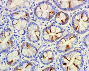 Immunohistochemistry (Formalin/PFA-fixed paraffin-embedded sections) - Anti-CD168 antibody [EPR4055] - Low endotoxin, Azide free (AB229447)
