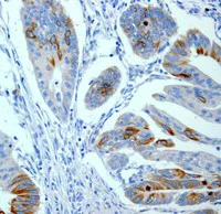 Immunohistochemistry (Formalin/PFA-fixed paraffin-embedded sections) - Anti-CD168 antibody [EPR4055] - Low endotoxin, Azide free (AB229447)