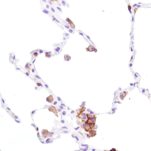 Immunohistochemistry (Formalin/PFA-fixed paraffin-embedded sections) - Anti-CD16a antibody [SP189] - BSA and Azide free (AB243936)