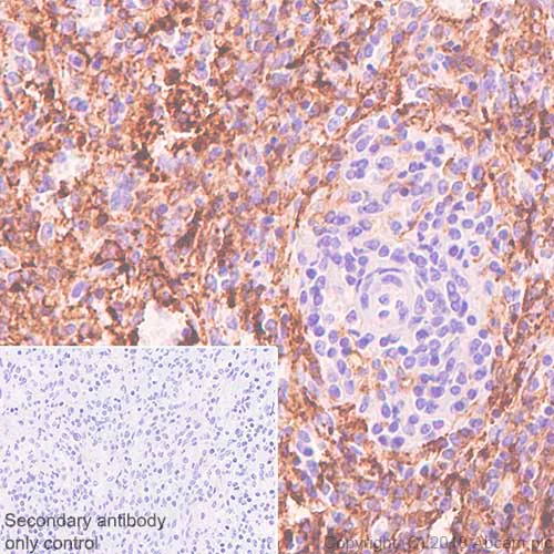 Immunohistochemistry (Formalin/PFA-fixed paraffin-embedded sections) - Anti-CD16a antibody [SP189] - BSA and Azide free (AB243936)