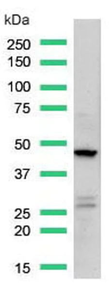 Western blot - Anti-CD16a antibody [SP189] - C-terminal (AB227665)