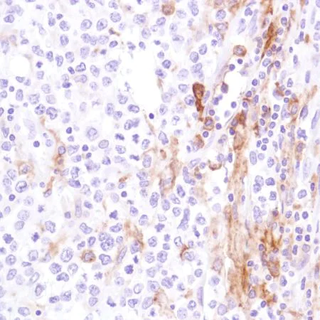Immunohistochemistry (Formalin/PFA-fixed paraffin-embedded sections) - Anti-CD16a antibody [SP189] - C-terminal, prediluted (AB228278)