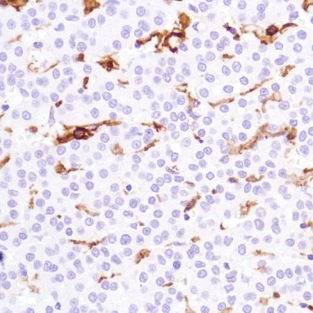 Immunohistochemistry (Formalin/PFA-fixed paraffin-embedded sections) - Anti-CD16a antibody [SP189] - C-terminal, prediluted (AB228278)