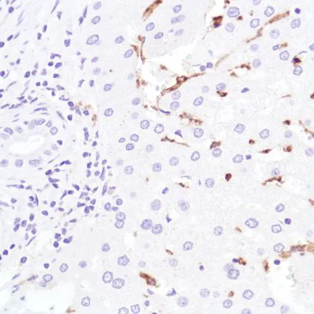Immunohistochemistry (Formalin/PFA-fixed paraffin-embedded sections) - Anti-CD16a antibody [SP189] - C-terminal, prediluted (AB228278)