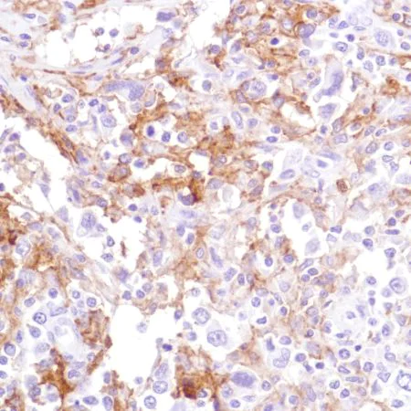 Immunohistochemistry (Formalin/PFA-fixed paraffin-embedded sections) - Anti-CD16a antibody [SP189] - C-terminal, prediluted (AB228278)