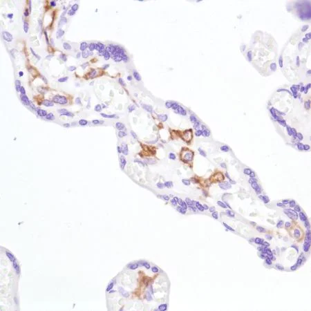 Immunohistochemistry (Formalin/PFA-fixed paraffin-embedded sections) - Anti-CD16a antibody [SP189] - C-terminal, prediluted (AB228278)