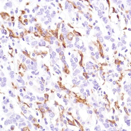 Immunohistochemistry (Formalin/PFA-fixed paraffin-embedded sections) - Anti-CD16a antibody [SP189] - C-terminal, prediluted (AB228278)