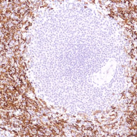 Immunohistochemistry (Formalin/PFA-fixed paraffin-embedded sections) - Anti-CD16a antibody [SP189] - C-terminal, prediluted (AB228278)