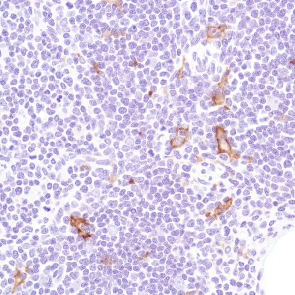 Immunohistochemistry (Formalin/PFA-fixed paraffin-embedded sections) - Anti-CD16a antibody [SP189] - Low endotoxin, Azide free (AB246798)