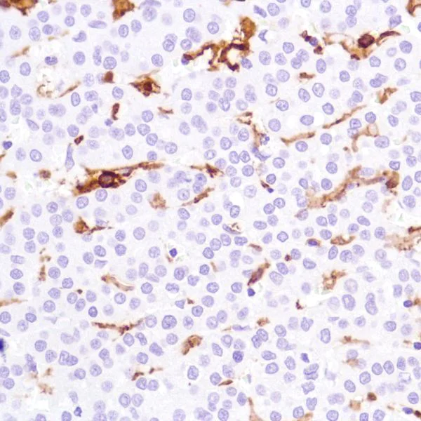 Immunohistochemistry (Formalin/PFA-fixed paraffin-embedded sections) - Anti-CD16a antibody [SP189] - Low endotoxin, Azide free (AB246798)