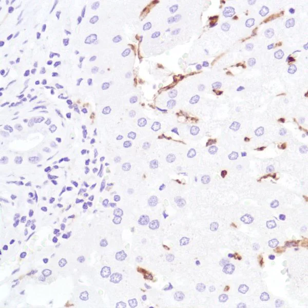 Immunohistochemistry (Formalin/PFA-fixed paraffin-embedded sections) - Anti-CD16a antibody [SP189] - Low endotoxin, Azide free (AB246798)