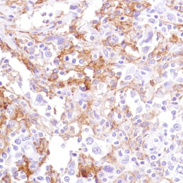 Immunohistochemistry (Formalin/PFA-fixed paraffin-embedded sections) - Anti-CD16a antibody [SP189] - Low endotoxin, Azide free (AB246798)