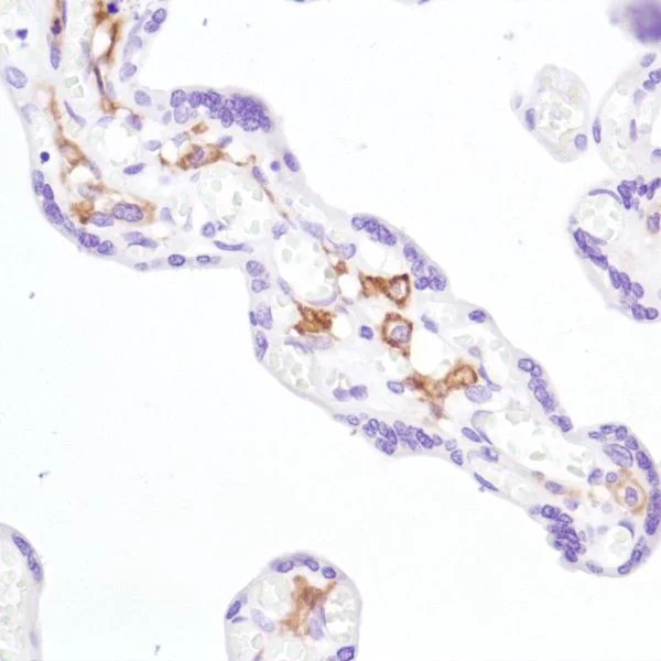 Immunohistochemistry (Formalin/PFA-fixed paraffin-embedded sections) - Anti-CD16a antibody [SP189] - Low endotoxin, Azide free (AB246798)