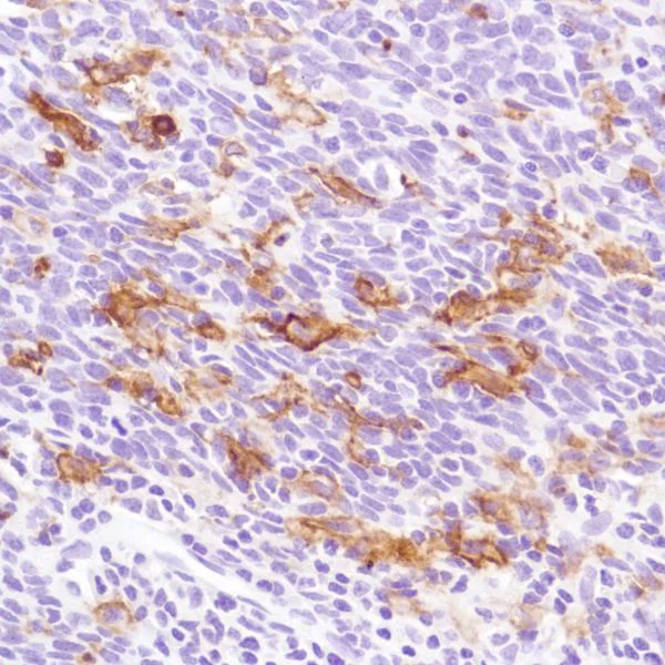 Immunohistochemistry (Formalin/PFA-fixed paraffin-embedded sections) - Anti-CD16a antibody [SP189] - Low endotoxin, Azide free (AB246798)