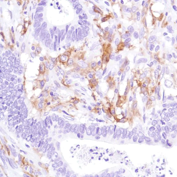 Immunohistochemistry (Formalin/PFA-fixed paraffin-embedded sections) - Anti-CD16a antibody [SP189] - Low endotoxin, Azide free (AB246798)