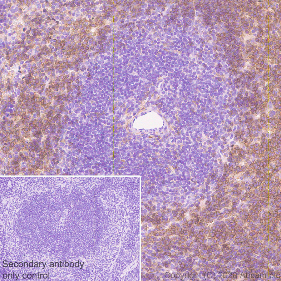 Immunohistochemistry (Formalin/PFA-fixed paraffin-embedded sections) - Anti-CD16+CD32 antibody [EPR23501-203] - BSA and Azide free (AB275095), expandable thumbnail