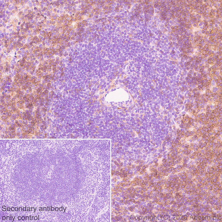 Immunohistochemistry (Formalin/PFA-fixed paraffin-embedded sections) - Anti-CD16+CD32 antibody [EPR23501-203] - BSA and Azide free (AB275095)