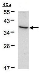 Western blot - Anti-CD172 gamma antibody (AB96064), expandable thumbnail