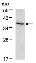 Western blot - Anti-CD172 gamma antibody (AB96064)